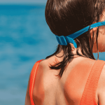 A young girl child experiencing sunburn