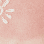 Sunburn issues PHCA Tips