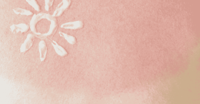 Comprehensive Sunburn Care: From Prevention to Recovery