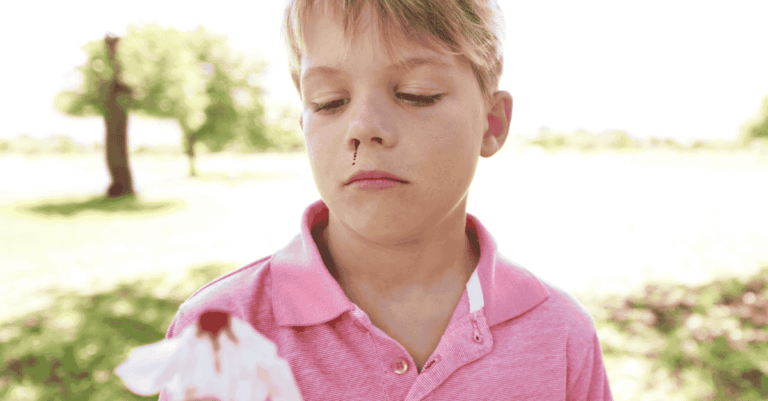 Nosebleeds in Children: Causes, Prevention, and When to Seek Help