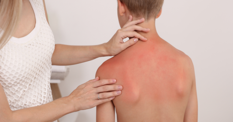 Sun Safety for Kids—Your Guide to a Burn-Free Summer