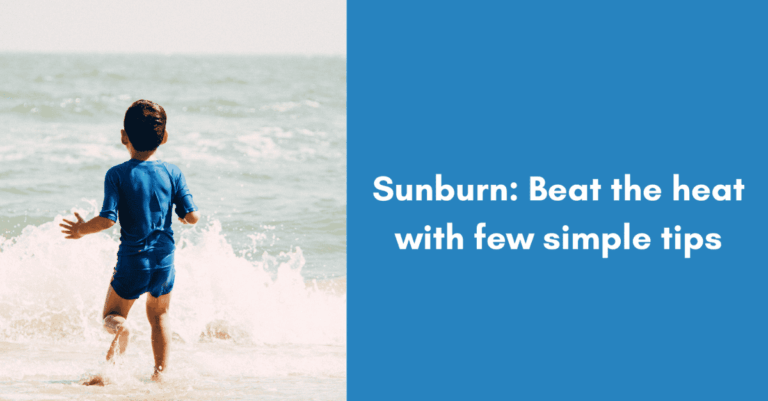 SunBurn: Beat the heat by following simple tips!